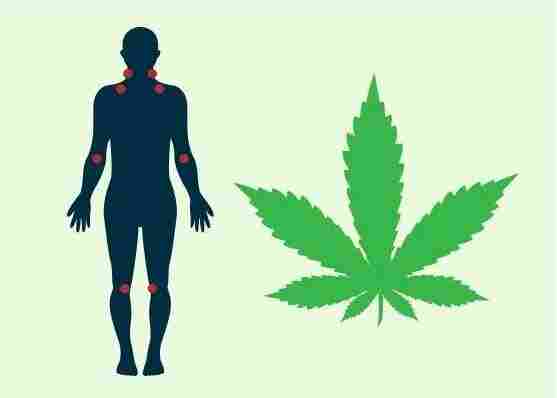 Unión de pacientes por la regularización del cannabis